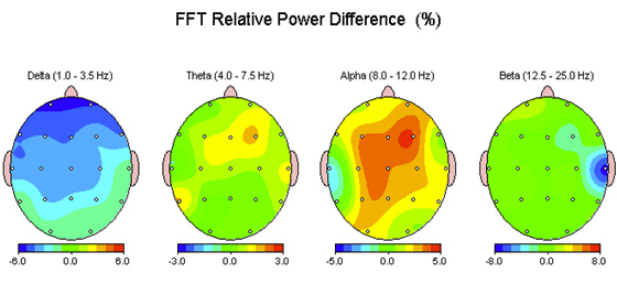 FTT Rrelative Power Difference